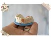 Magnet personalizat pentru dentisti