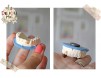 Magnet personalizat pentru dentisti